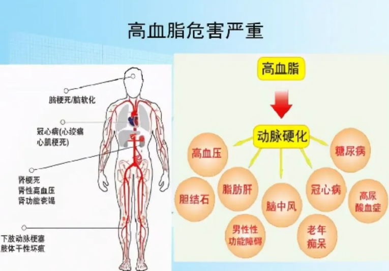 三高患者必看！这个方法可改善三高问题，有效防止并发症！